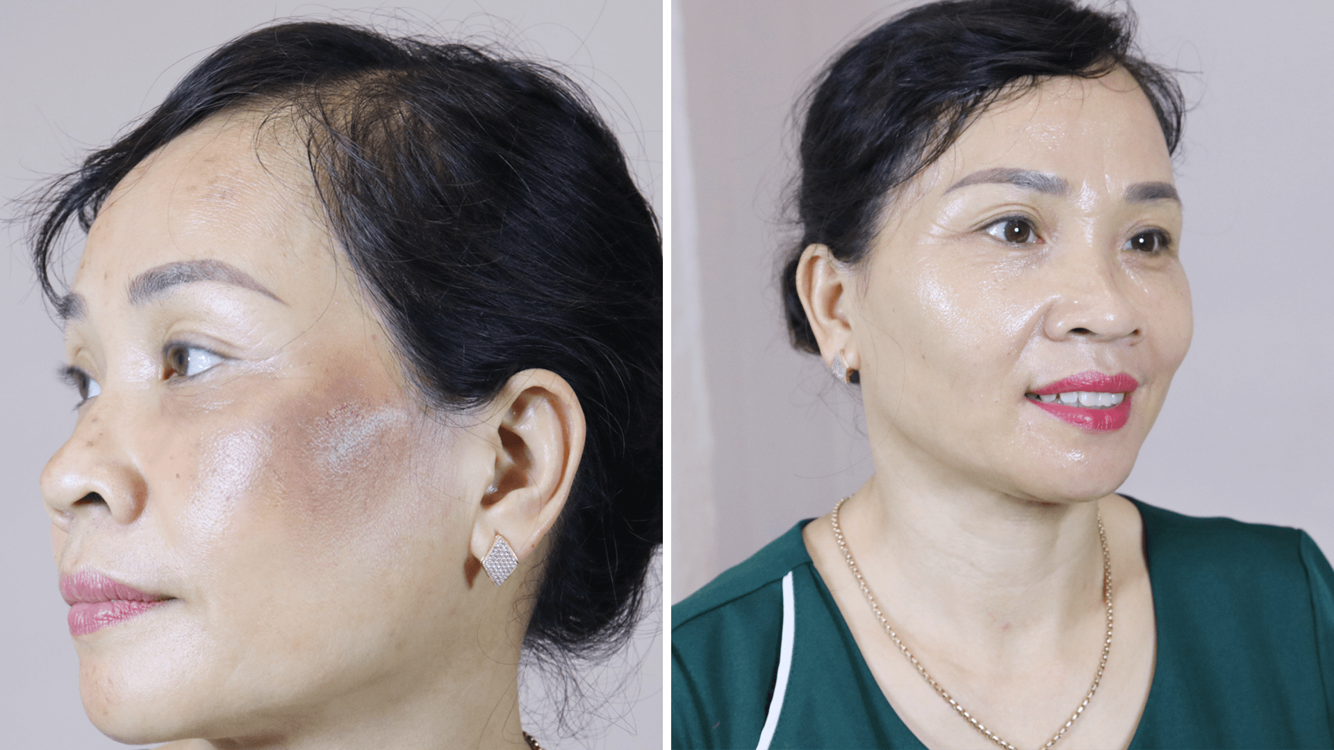 Công nghệ 4F ULTRANANOSKIN phục hồi tất cả các làn da 32 1 7 1