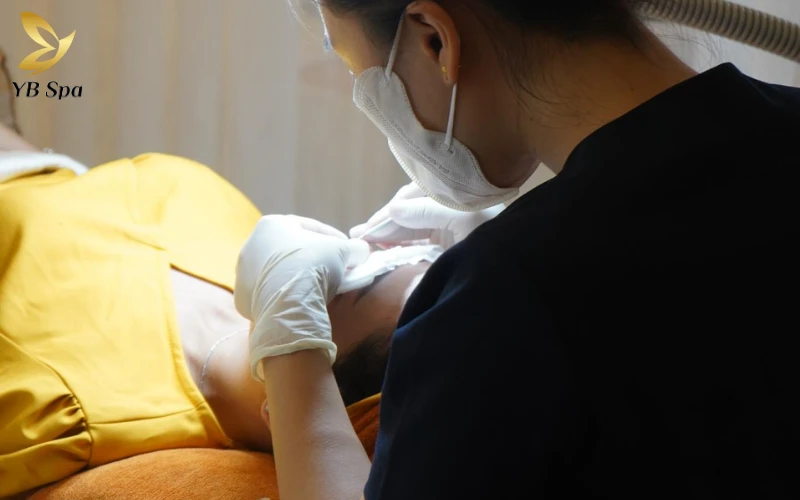 1 liệu trình trị mụn tại spa bao nhiêu tiền