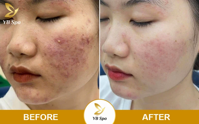 Cam kết hiệu quả thực tế