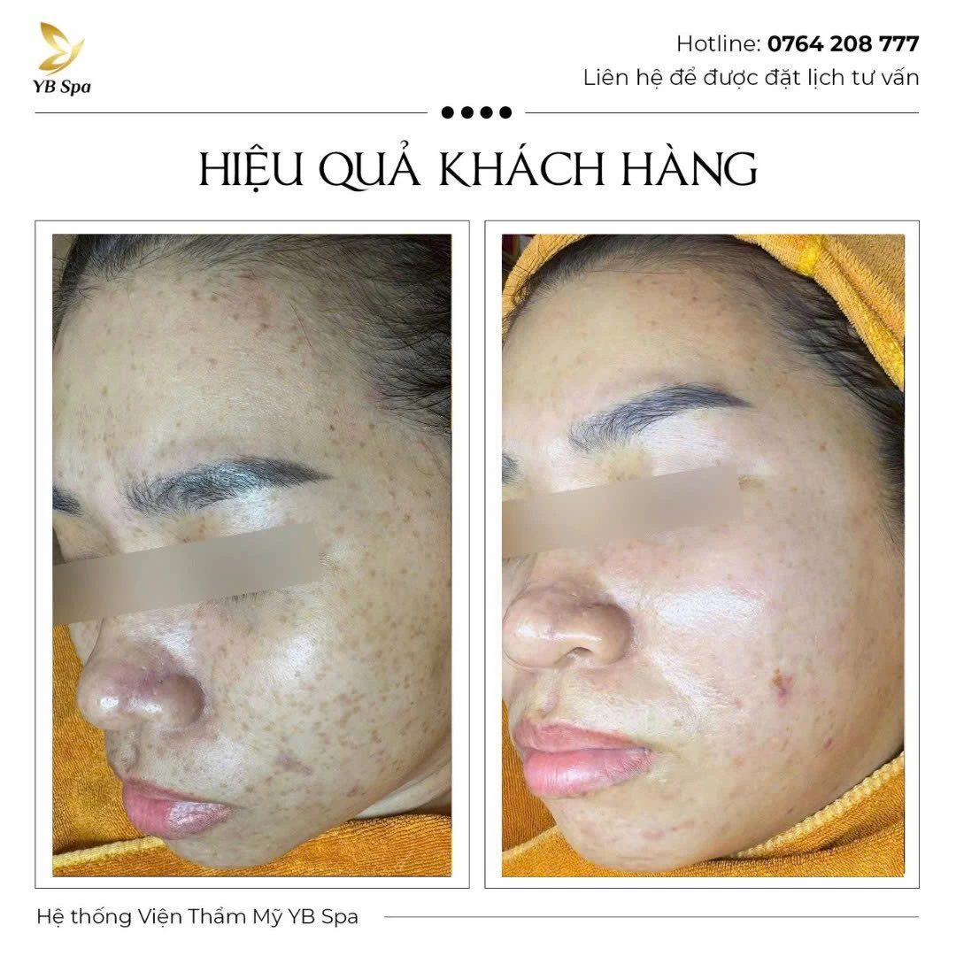 Trang chủ 77 Trang chủ