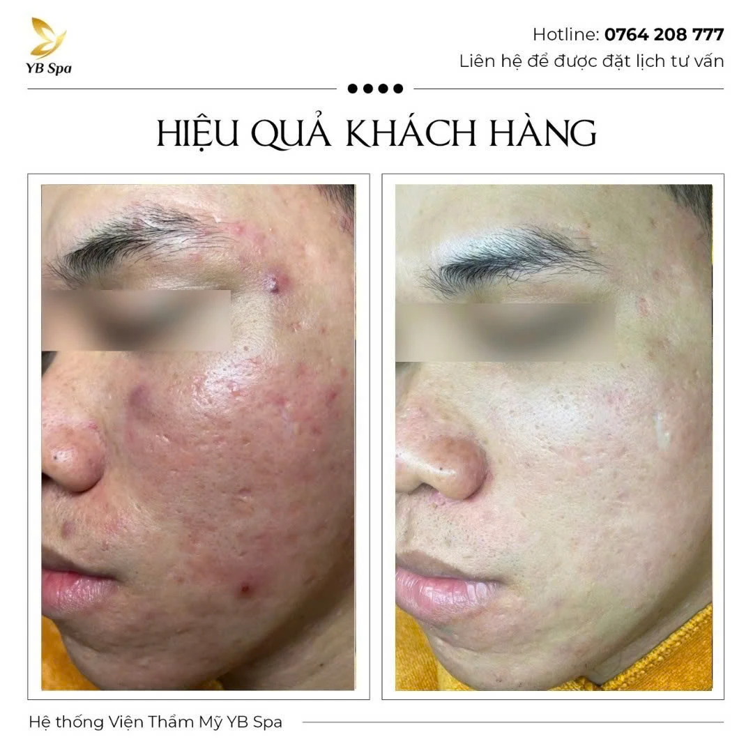 Trang chủ 74 Trang chủ