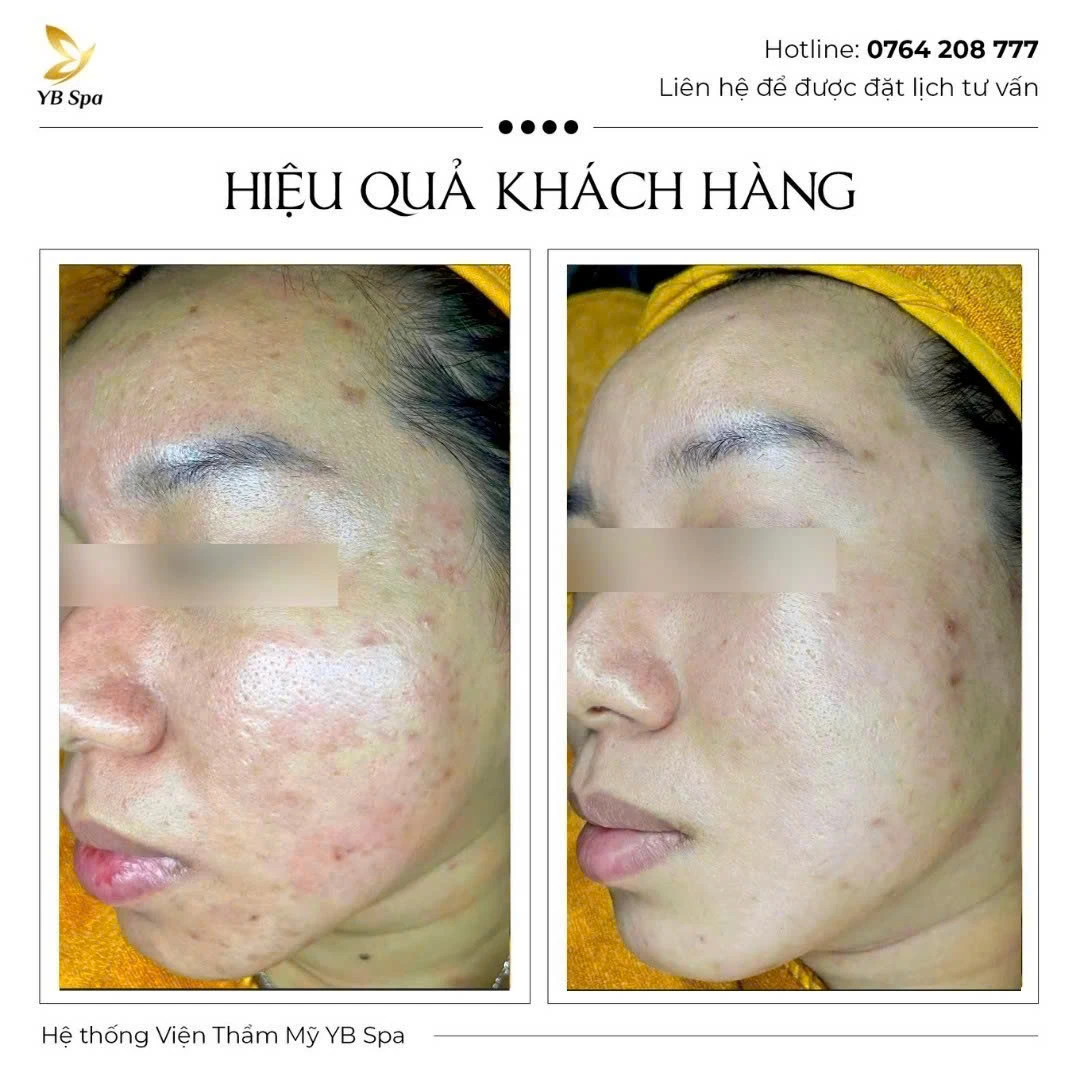 Trang chủ 66 Trang chủ