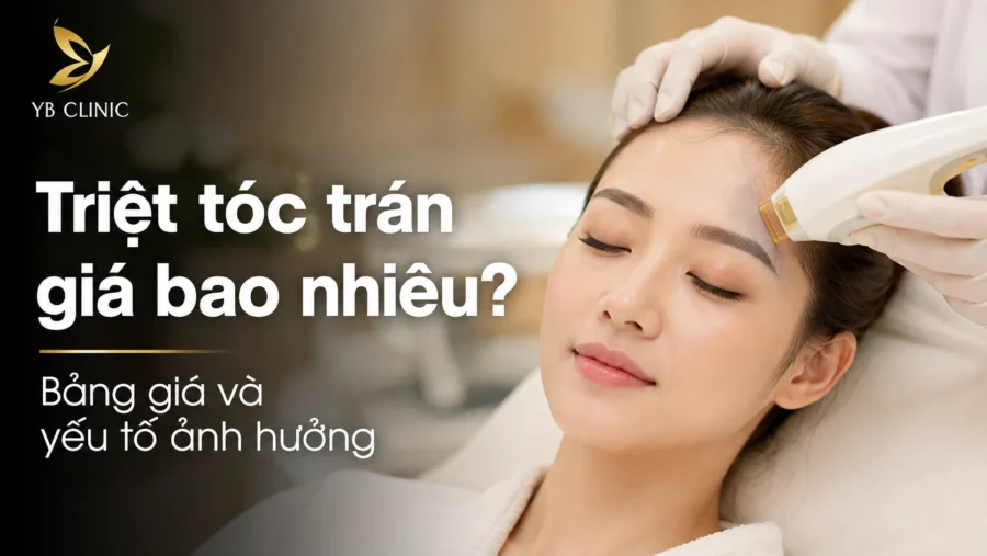 Triệt tóc trán giá bao nhiêu? Bảng giá và yếu tố ảnh hưởng