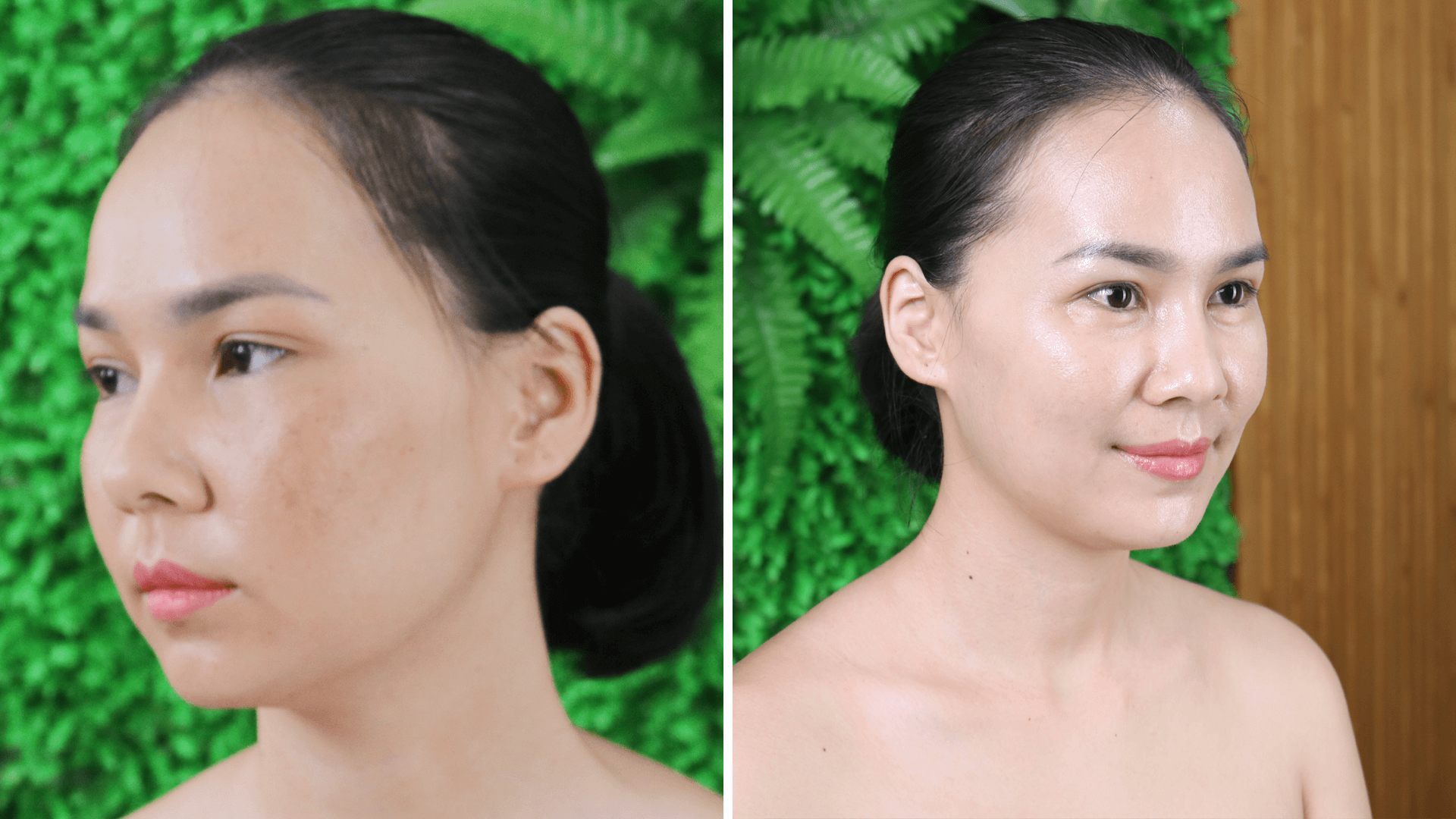 Công nghệ 4F ULTRANANOSKIN phục hồi tất cả các làn da 33 2 5 1