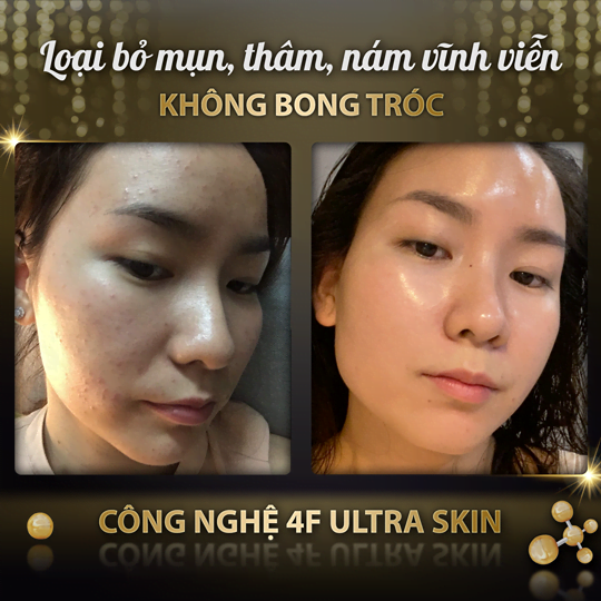 Viện Thẩm Mỹ YB Spa