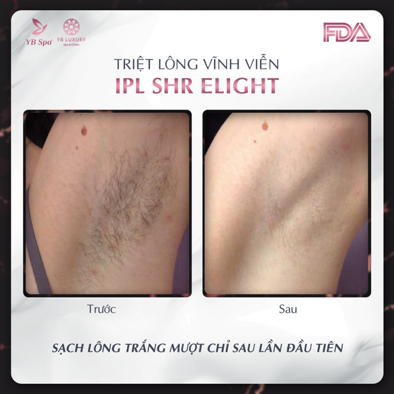 Viện Thẩm Mỹ YB Spa