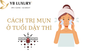 Cách trị mụn tại nhà ở tuổi dậy thì