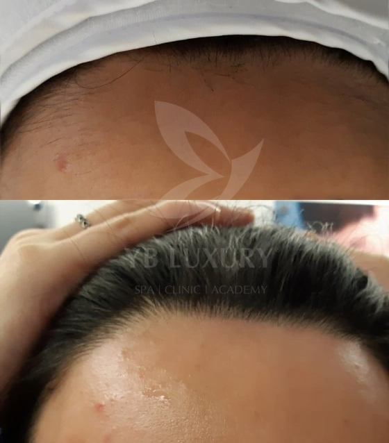 Viện Thẩm Mỹ YB Spa