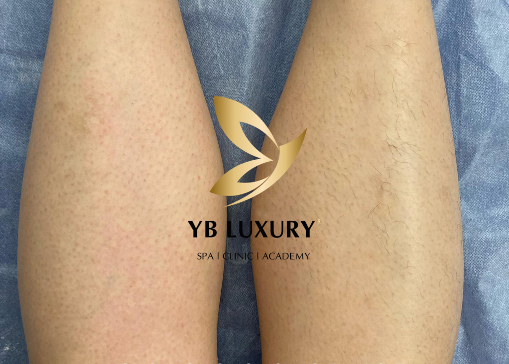 Viện Thẩm Mỹ YB Spa