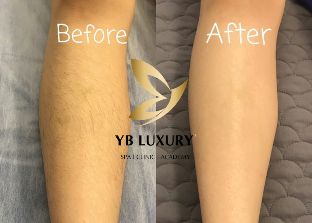 Viện Thẩm Mỹ YB Spa