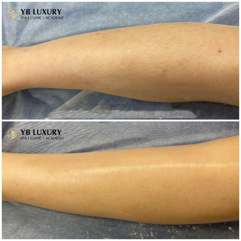 Viện Thẩm Mỹ YB Spa