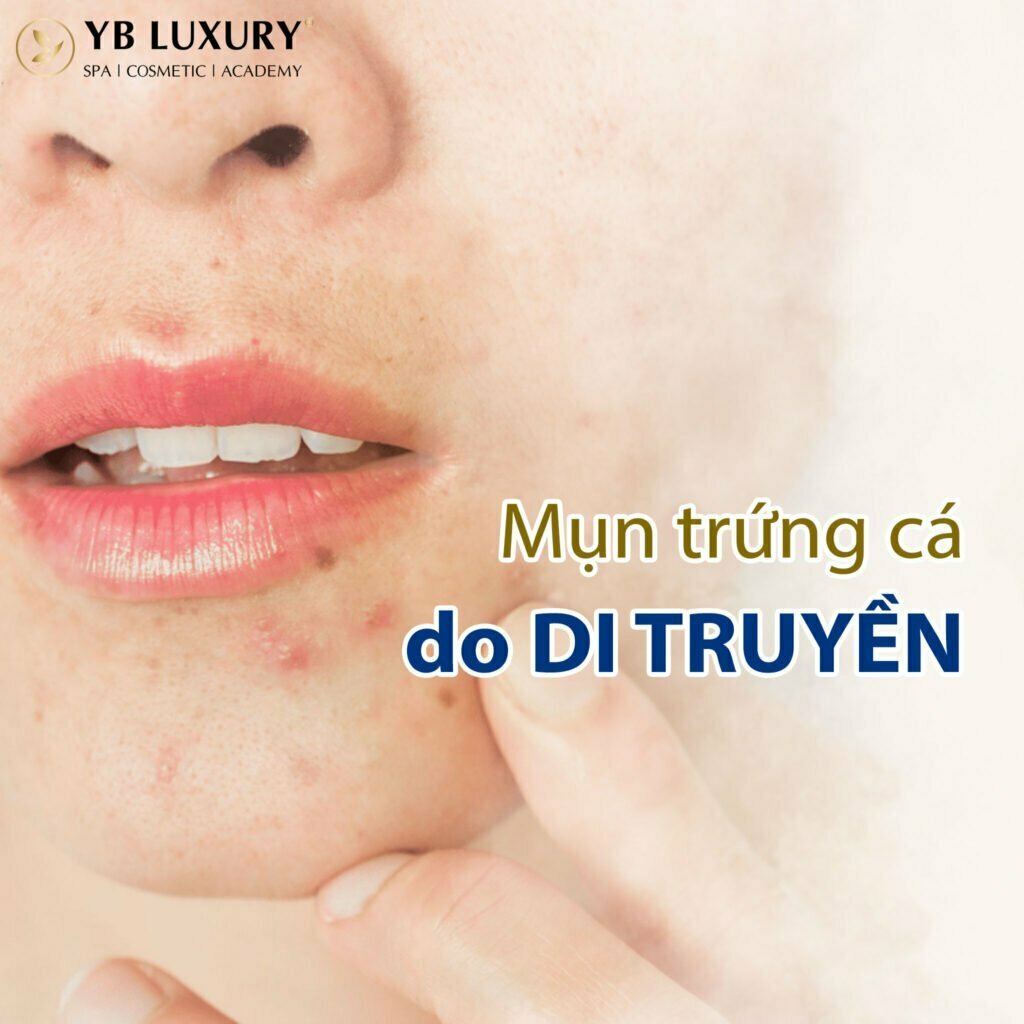 Viện Thẩm Mỹ YB Spa