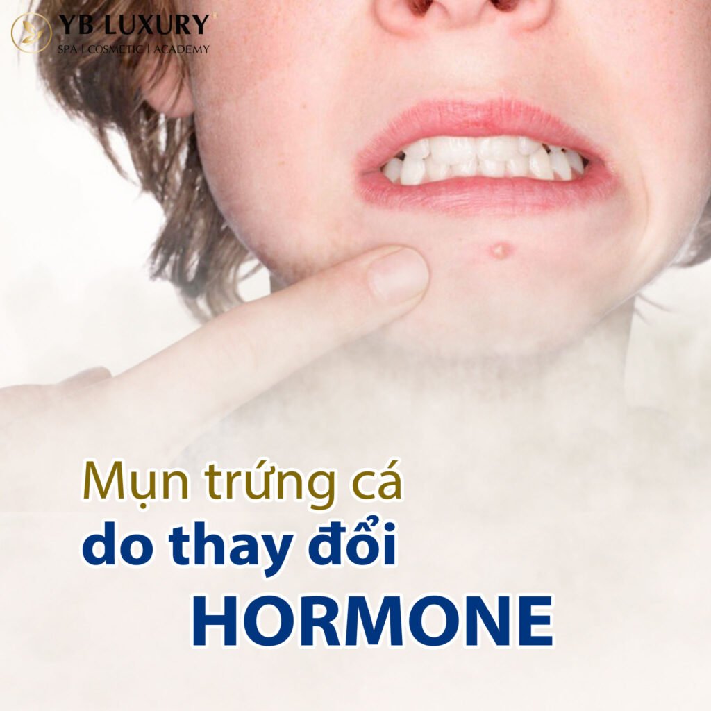 Viện Thẩm Mỹ YB Spa