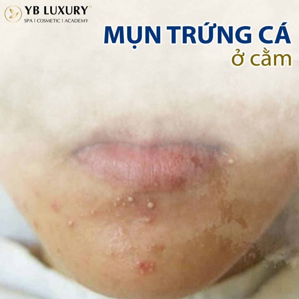 Viện Thẩm Mỹ YB Spa