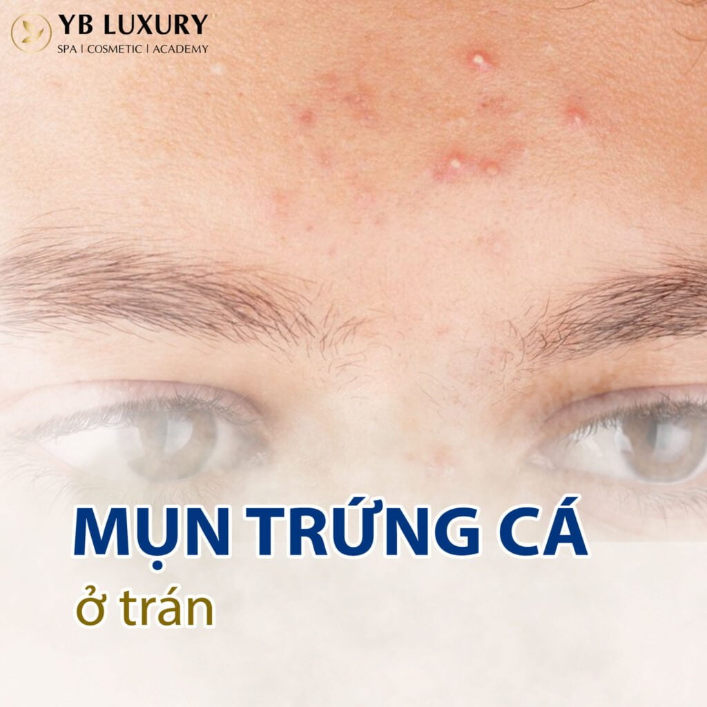 Viện Thẩm Mỹ YB Spa