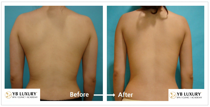 Viện Thẩm Mỹ YB Spa