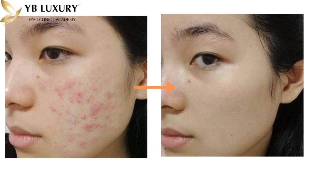 Viện Thẩm Mỹ YB Spa