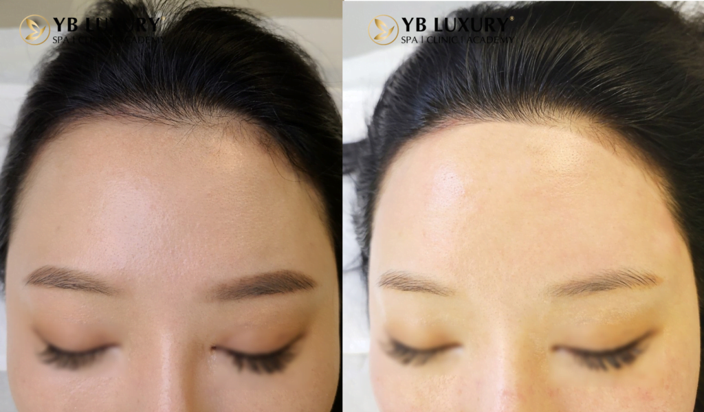 Viện Thẩm Mỹ YB Spa
