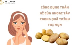 Cách trị mụn bằng khoai tây
