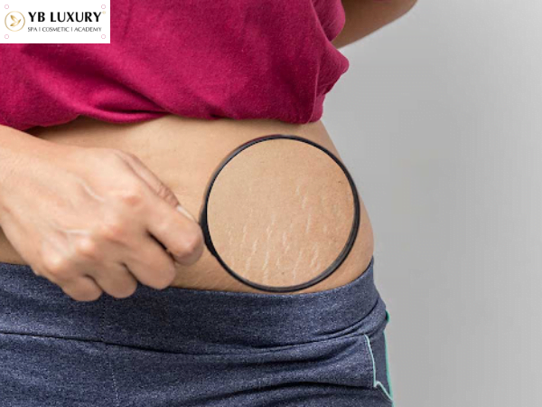 Cách chăm sóc da mặt sau sinh hiệu quả