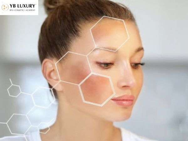 Sau sinh xuất hiện nám và tàn nhang