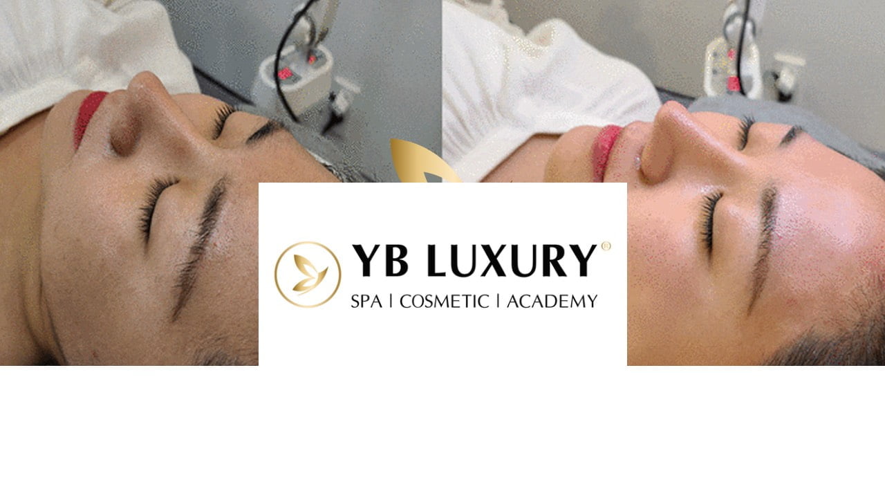 Ảnh khách hàng trước và sau khi điều trị mụn của YB Spa