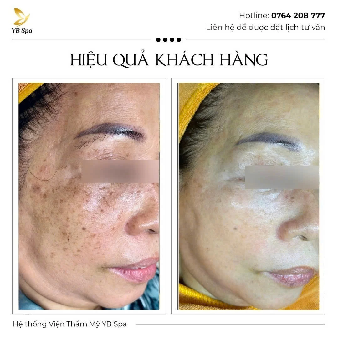 Trang chủ 52 Trang chủ