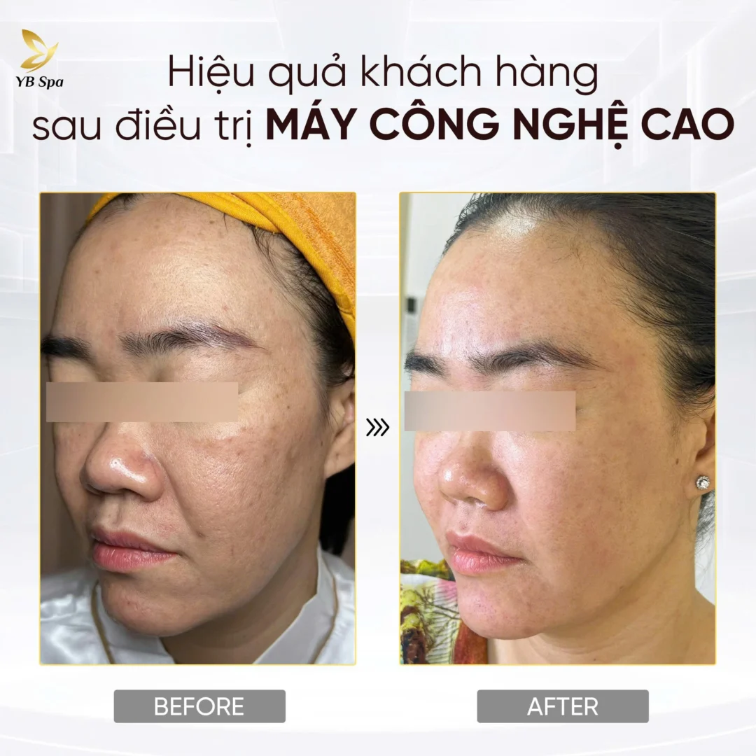 Trang chủ 87 Trang chủ