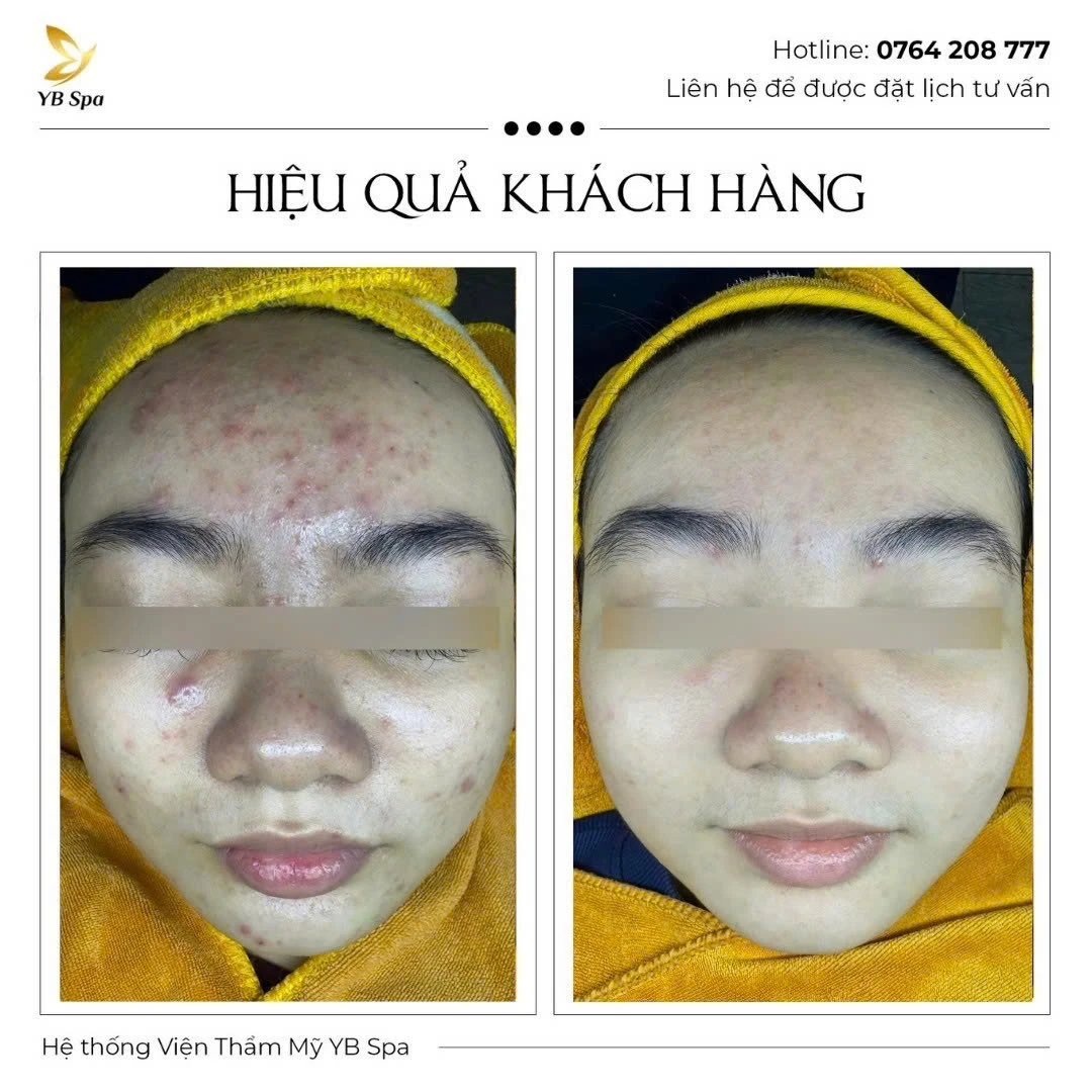 Trang chủ 65 Trang chủ