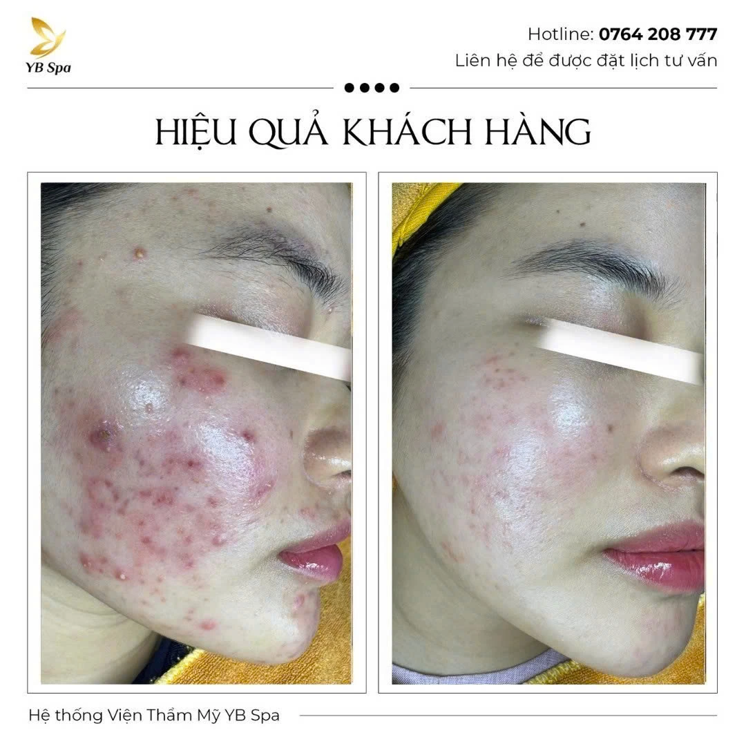 Trang chủ 62 Trang chủ