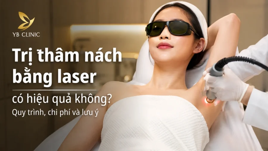 Trị thâm nách bằng laser có hiệu quả không? Quy trình, chi phí và lưu ý