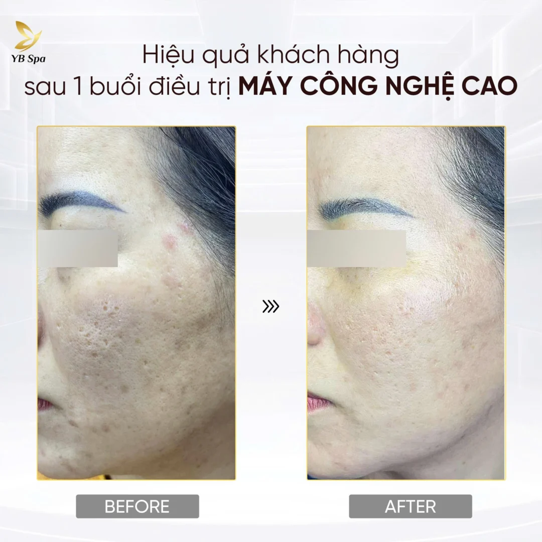 Trang chủ 95 Trang chủ