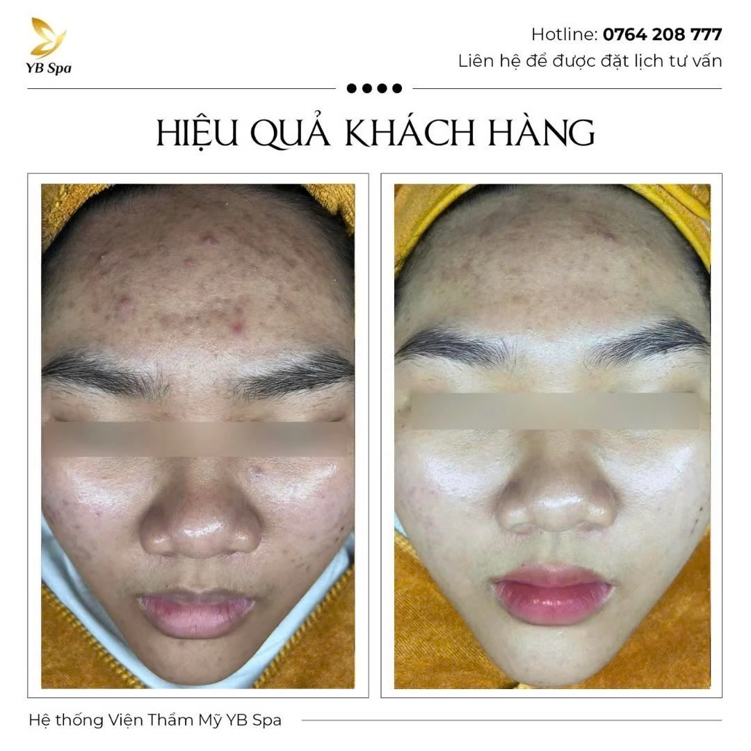 Trang chủ 70 Trang chủ