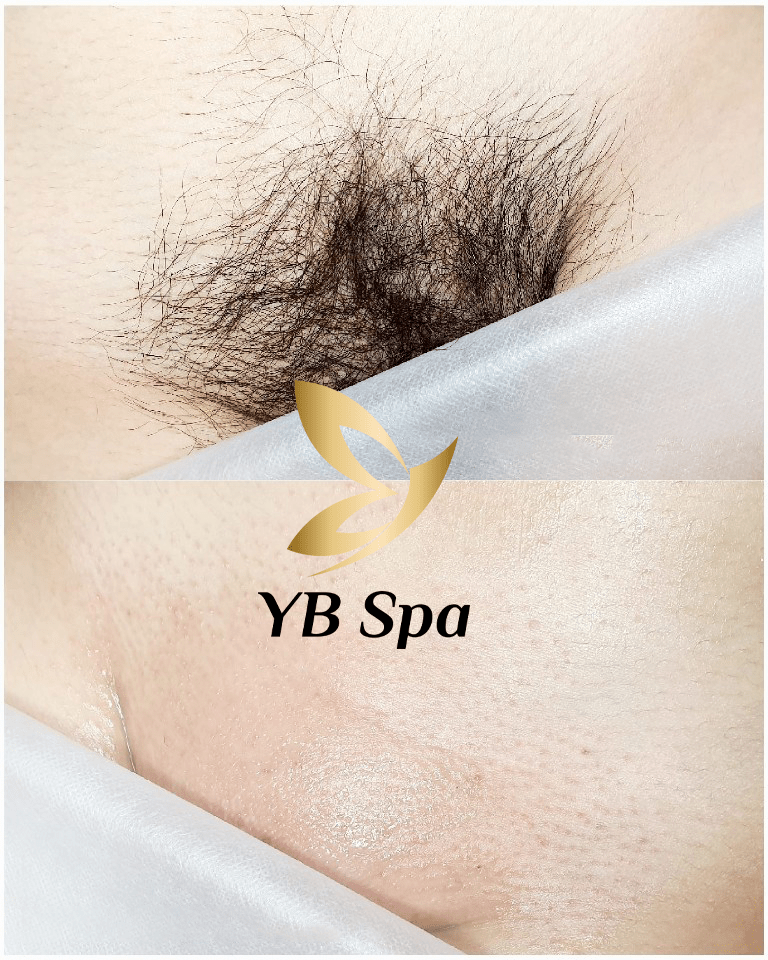 B8ebbca7ebac96ec818bb1 Copy