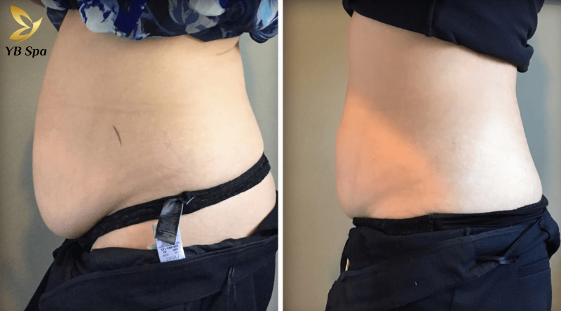 Cập nhật bảng giá Spa uy tín nhất TP Hồ Chí Minh