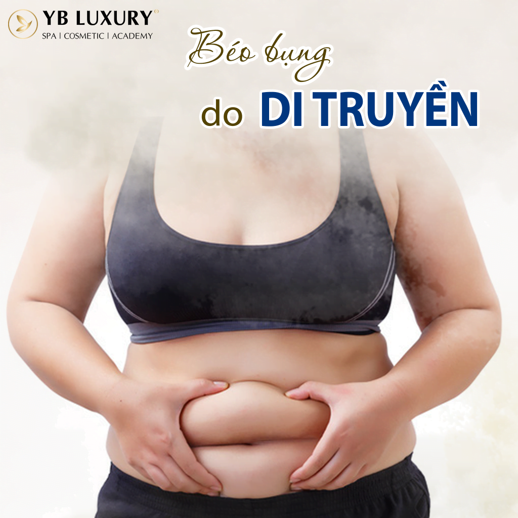 Giảm mỡ bụng AN TOÀN bằng công nghệ Contri-lipo 23 Beo Bung Do Di Truyen 1024x1024