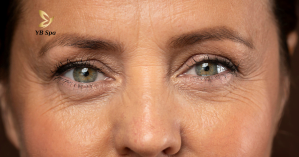 cach-lam-giam-nep-nhan-tai-nha