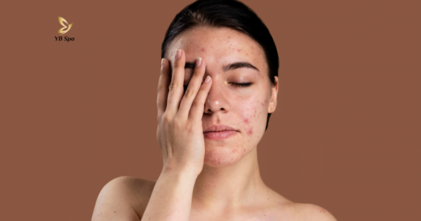 Triệt lông mặt có khiến da bị mỏng đi không? 21 Triệt lông mặt sẽ không khiến da bị mỏng đi