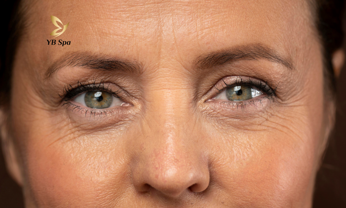 nguyen-nhan-gay-nep-nhan