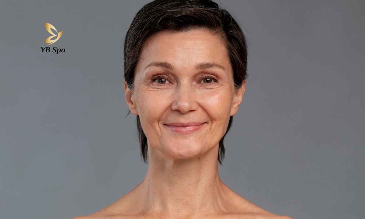 Xoá rãnh cười: Nên hay không? Câu trả lời từ chuyên gia 20 xoa-ranh-cuoi