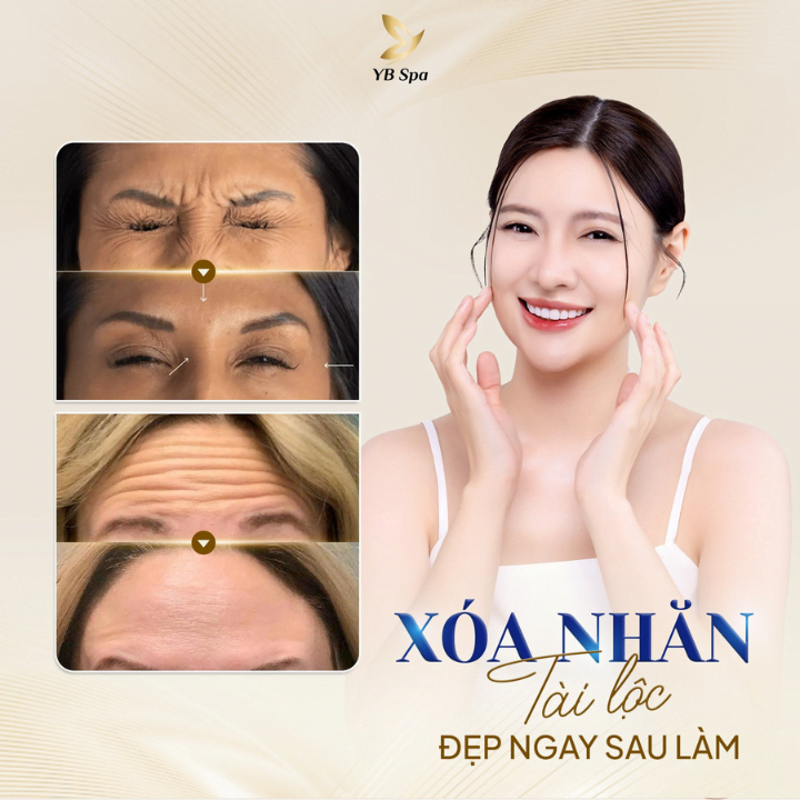 phuong-phap-xoa-nep-nhan-tren-tran