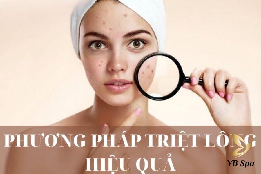 Tại sao triệt lông mặt lại nổi mụn? Có nên triệt lông mặt? 24 Các phương pháp triệt lông mặt