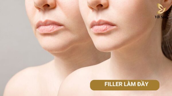 Thêm Tiêu đề (1)