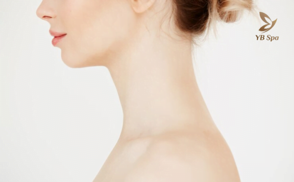 Cấy thon gọn cằm