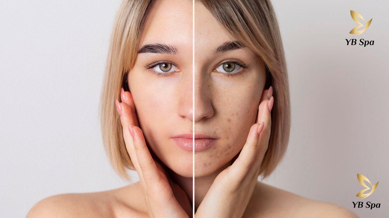 kinh-nghiem-peel-image