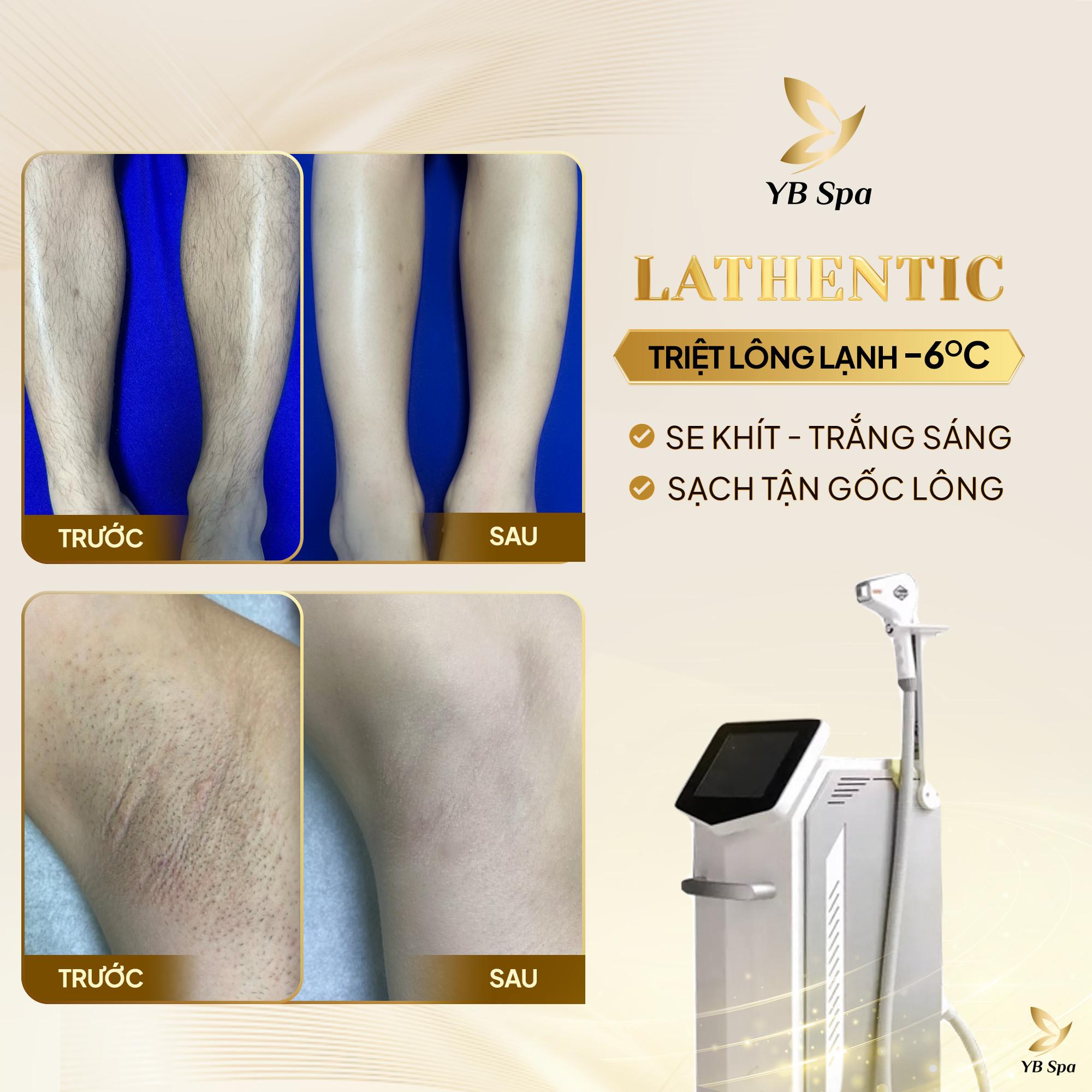 Triệt lông vĩnh viễn: Sự thật và hiệu quả 18 Triệt Lông Vĩnh Viễn 2