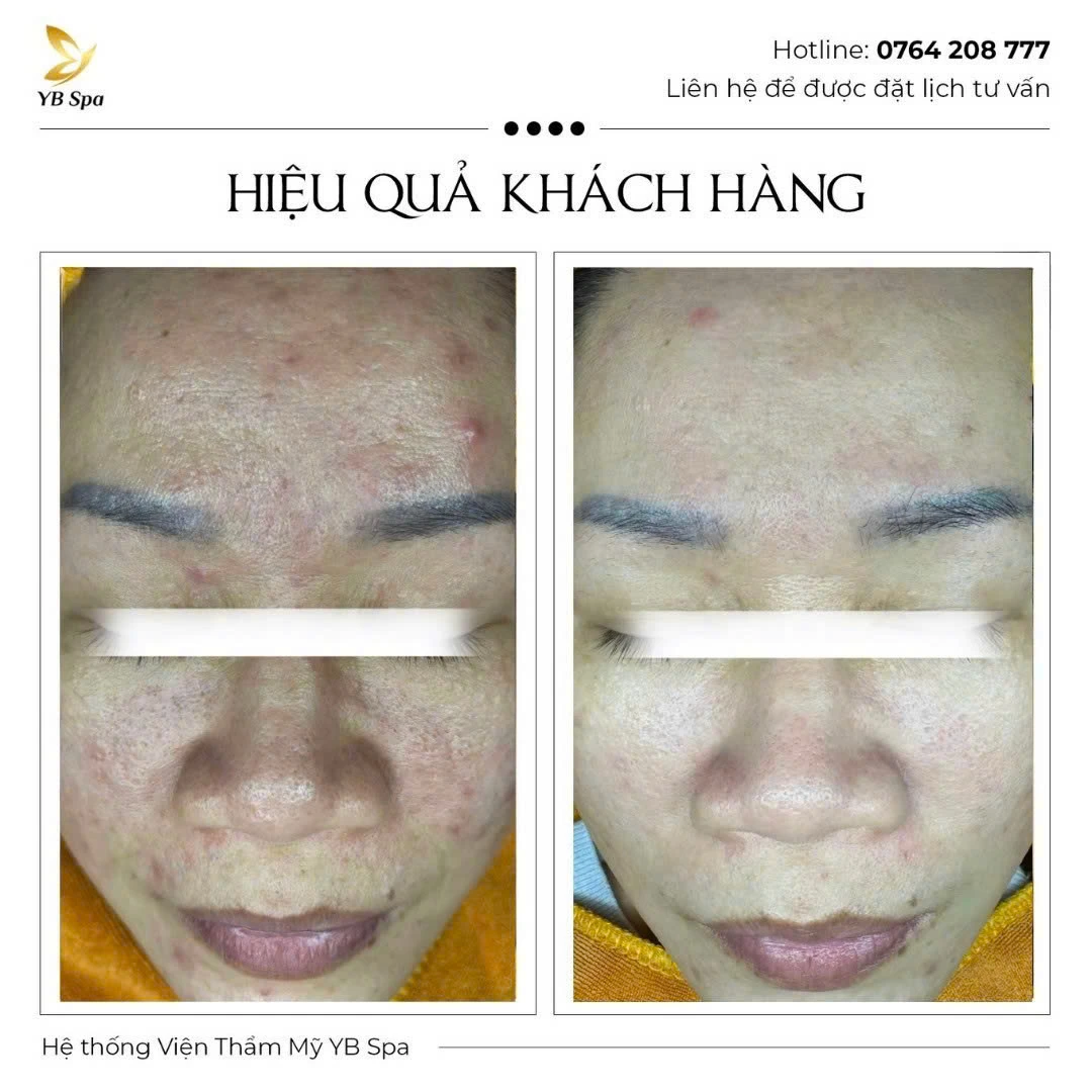 Trang chủ 72 Trang chủ