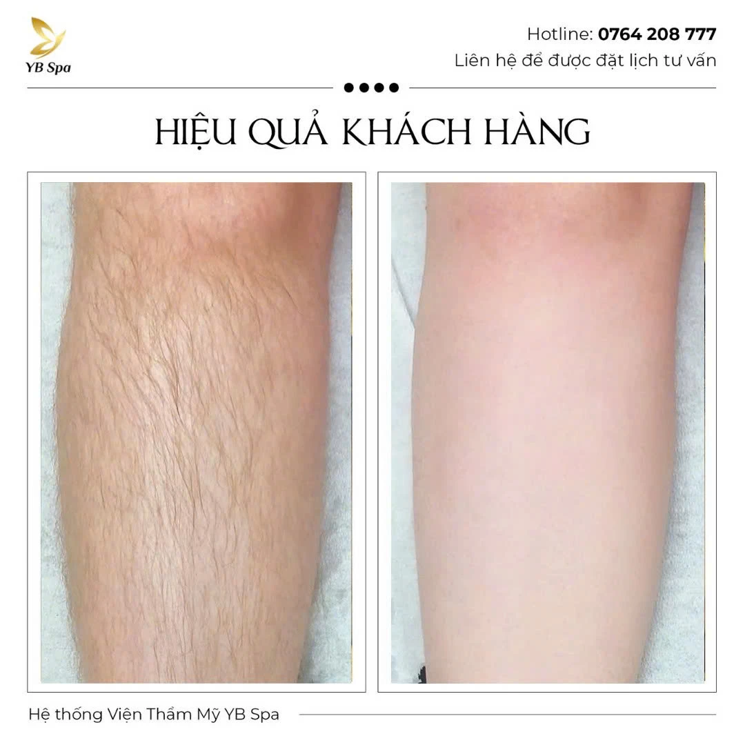 Trang chủ 100 Trang chủ