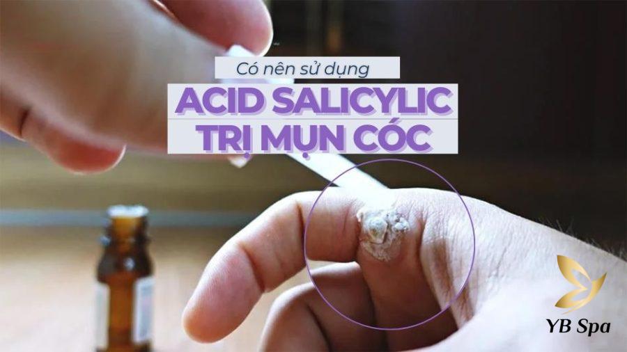 Có nên sử dụng acid salicylic trị mụn cóc hay không?