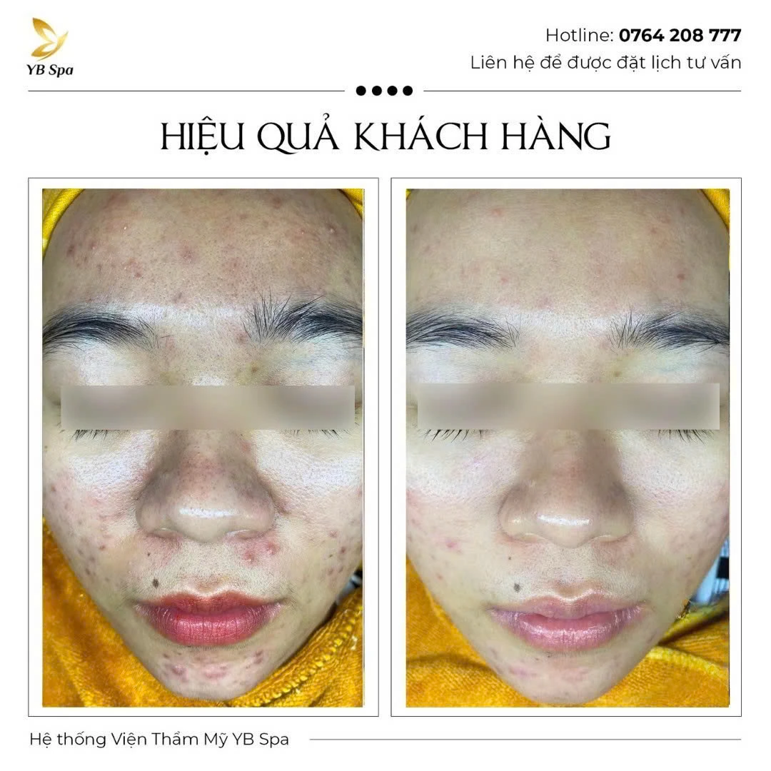 Trang chủ 64 Trang chủ